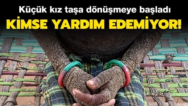 Küçük kız taşa dönüşmeye başladı