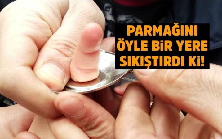 İmdadına itfaiye yetişti…