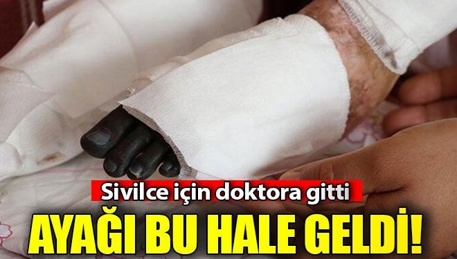 Sivilce için doktora gitmişti