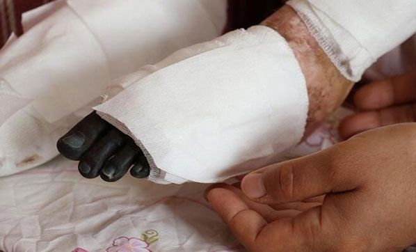 Sivilce için doktora gitmişti Sivilce için doktora gitmişti