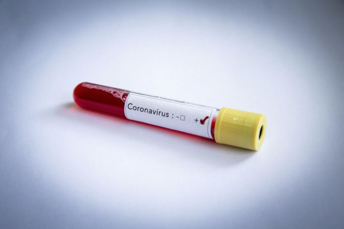 Koronavirüsün uzaydan mı geldi?