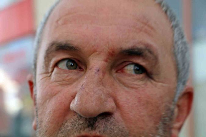 Yanlışlık yüzünden dayak yedi!