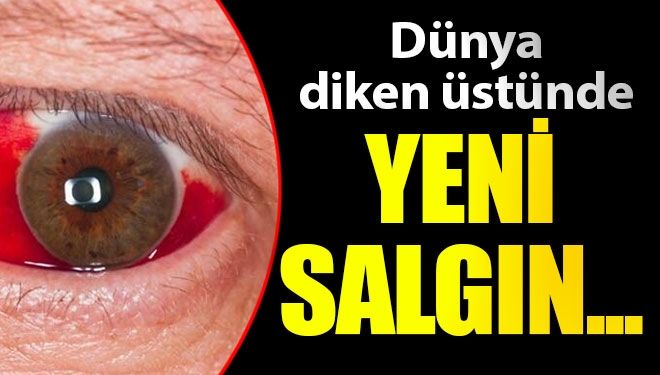 Dünya diken üstünde! Gizemli hastalık salgına dönüşebilir