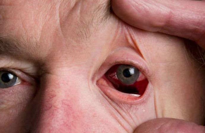 Dünya diken üstünde! Gizemli hastalık salgına dönüşebilir