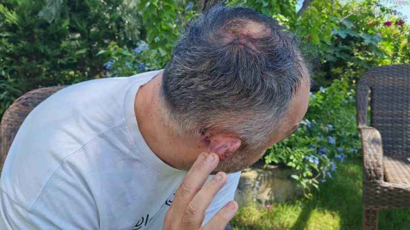 Spor yorumcusu ve işletmeci Levent Bulut öldüresiye dövülüp gasp edildi Spor yorumcusu ve işletmeci Levent Bulut öldüresiye dövülüp gasp edildi
