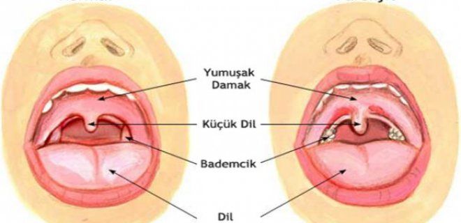 Farenjite ne iyi gelir?