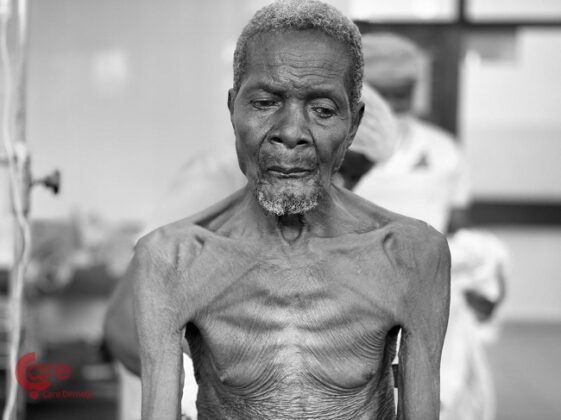 Çare Doktorları Ameliyatlara Devam Ediyor!