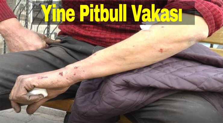 Çeşitli Yerlerinden Yaralandı