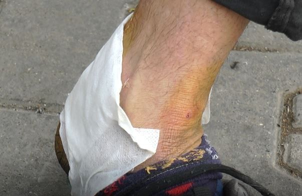 Çeşitli Yerlerinden Yaralandı