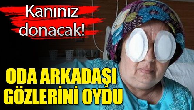 Oda arkadaşı gözlerini oydu