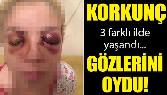 Saldırıyı anlattı