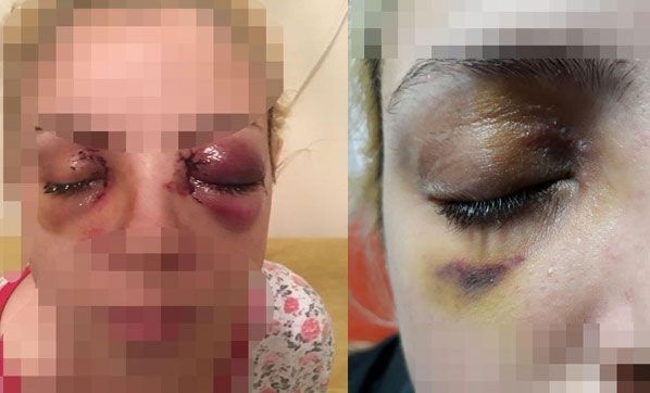 Saldırıyı anlattı Saldırıyı anlattı