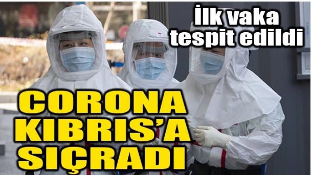 CORONA KIBRIS’A SIÇRADI