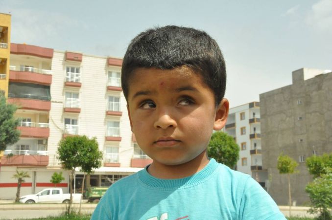 Savaş mağduru çocuğa tümör darbesi