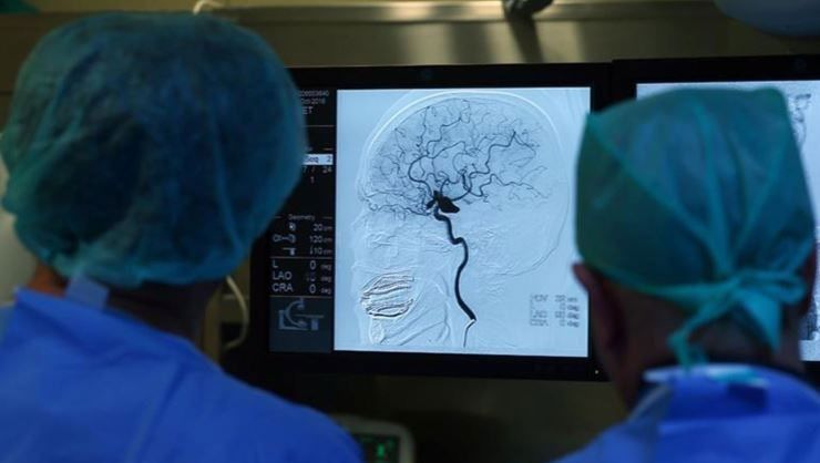 İnme nedir? İnme inen birine nasıl müdahale edilir, belirti ve tedavi yöntemleri nelerdir?