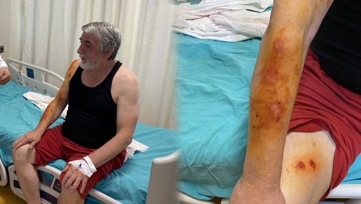 Lavabo açıcı bomba gibi patladı! Soluğu hastanede aldı