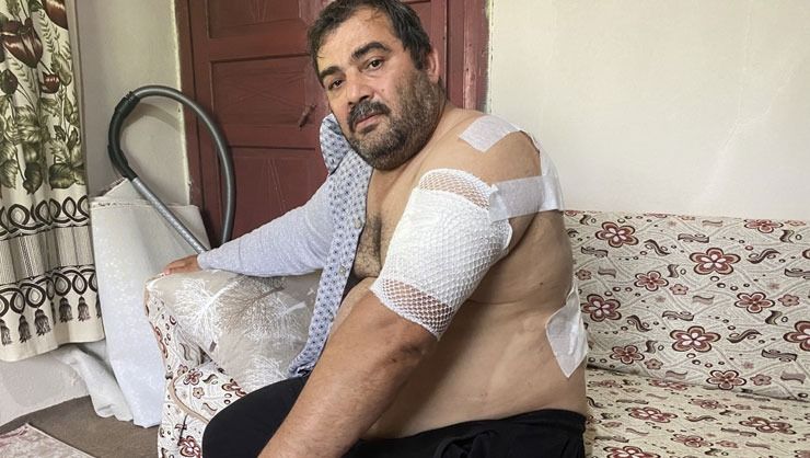 Ayı saldırısına uğrayan vatandaş: ‘Beni öldü zannetti’