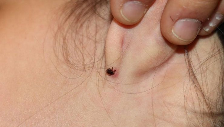 Uzman doktordan kene uyarısı