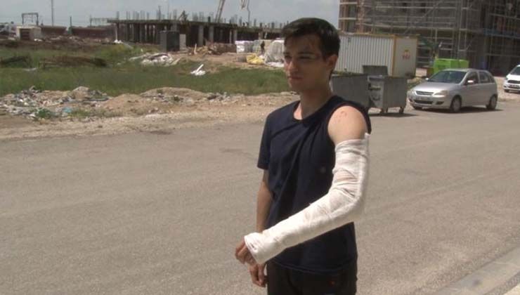 Bisikletiyle üniversiteye giden Barış Kar sokak köpeklerinin saldırısına uğradı