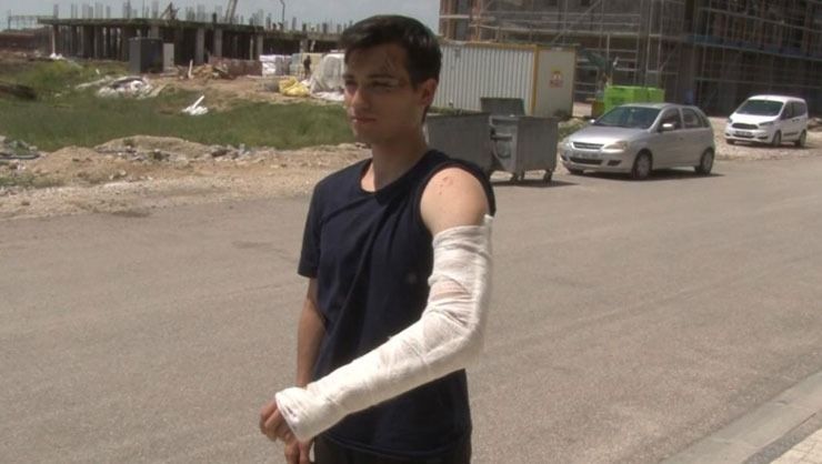 Bisikletiyle üniversiteye giden öğrenci sokak köpeklerinin saldırısına uğradı