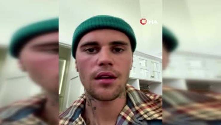 Justin Bieber yüz felci geçirdi