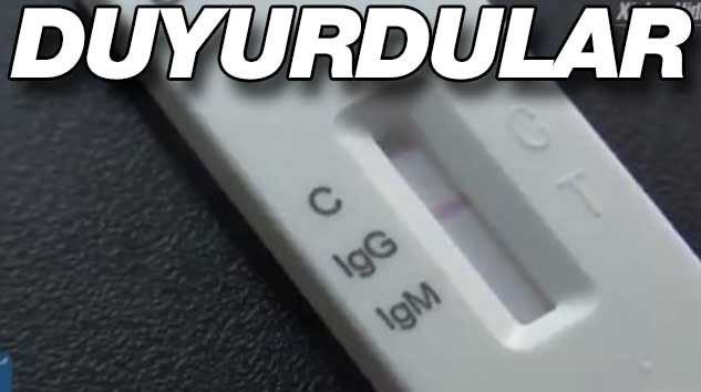 Kritik gelişmeyi duyurdular! Kit üretildi