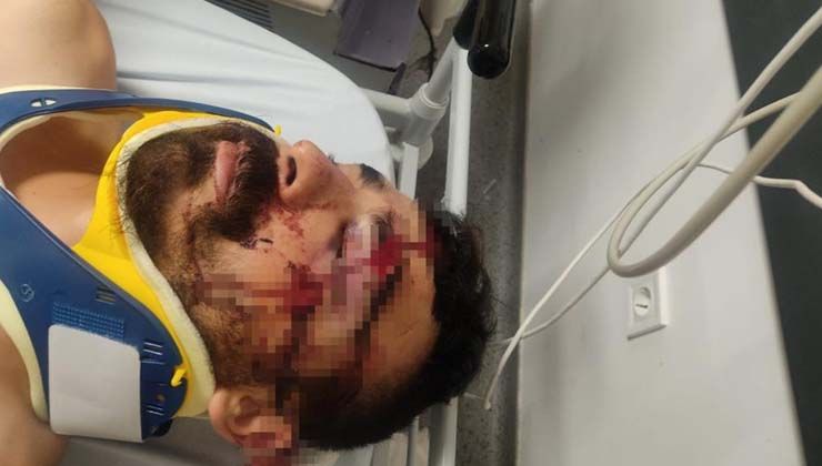 Kaza yapan kamyon sürücüsüne, komaya sokan dayak