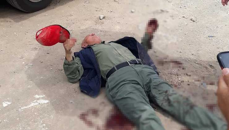 Yaşlı adama çocuk parkı yanında köpek saldırdı