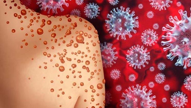 Uzmanından rahatlatan maymun çiçeği açıklaması