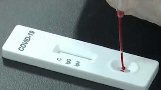 Türk çift üretti! Sadece 3 dakikada Koronavirüs’ü tespit ediyor