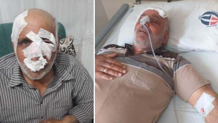 Köpeklerin saldırdığı Mustafa Topal iki ay sonra hayatını kaybetti