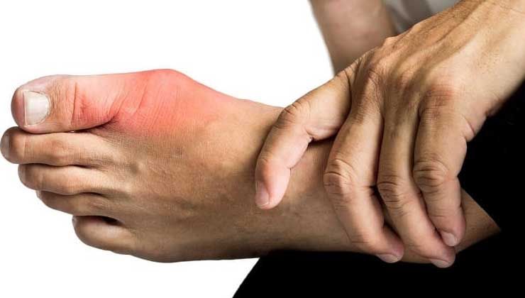 Bayramda fazla et tüketmeyin! Gut hastalığına yol açıyor