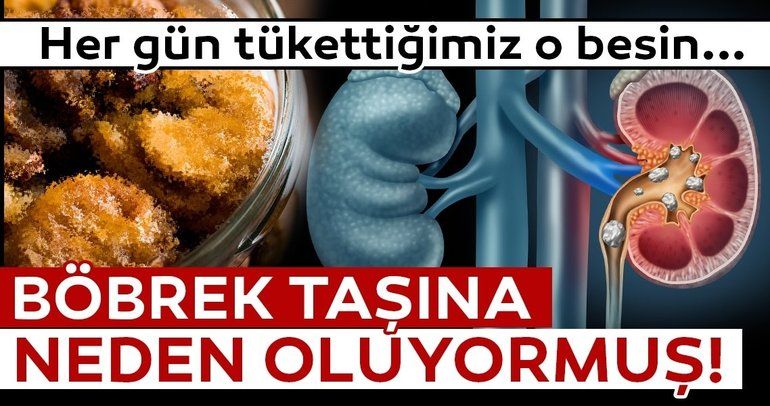 Her gün tükettiğimiz o besin meğer böbrek taşına neden oluyormuş!