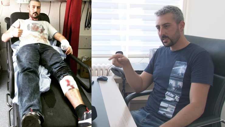 15 Temmuz Gazisi Ünal Çamdal elindeki ve bacağındaki şarapnel ile yaşıyor