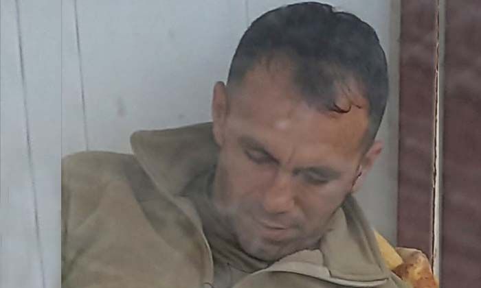 Adıyaman’da Gazi Atlı hayatını kaybetti