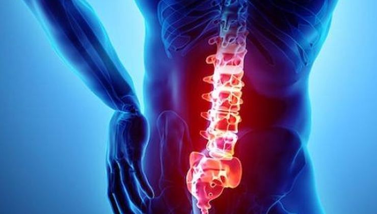 Bel kayması sosyal hayatı olumsuz yönde etkiliyor