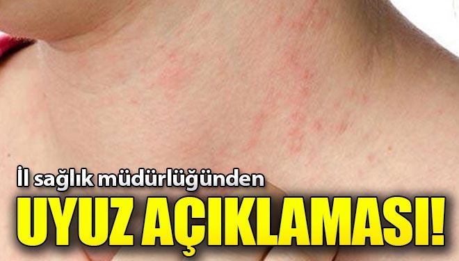 İstanbul İl Sağlık Müdürü Memişoğlu’ndan “Uyuz” açıklaması