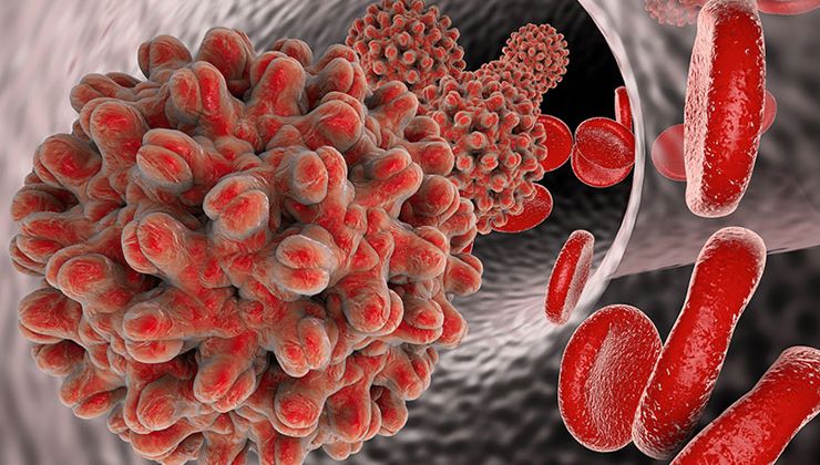 Uzmanlar uyarıyor, hepatite dikkat: 1998’den önce doğanlar mutlaka test yaptırsın