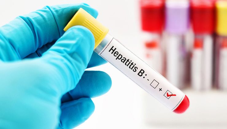 “Hepatit B ve C, siroza ya da karaciğer kanserine yol açabilir”