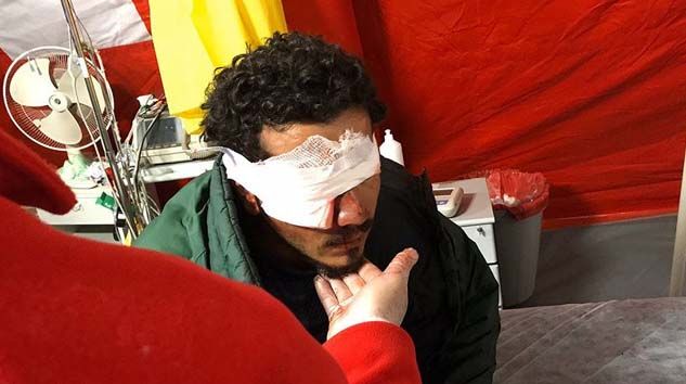 Yunanistan’ın attığı plastik mermi sığınmacıyı gözünden etti