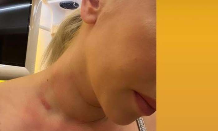 Ece Seçkin’e atılan telefon gözünü çıkarıyordu