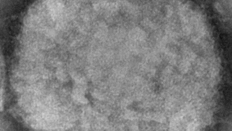 Maymun çiçeği korkutuyor! 6 kıtaya yayıldı