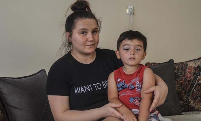 Köpeklerin saldırdığı 3 yaşındaki Miraç’ın yüzü parçalandı