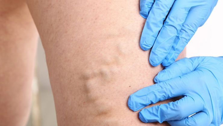 Aman dikkat! Erken evredeyken mutlaka kontrol ettirin