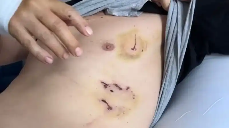  Bursa’da başıboş köpek dehşeti kamerada...Oğlu için kendini feda etti ölümden döndü