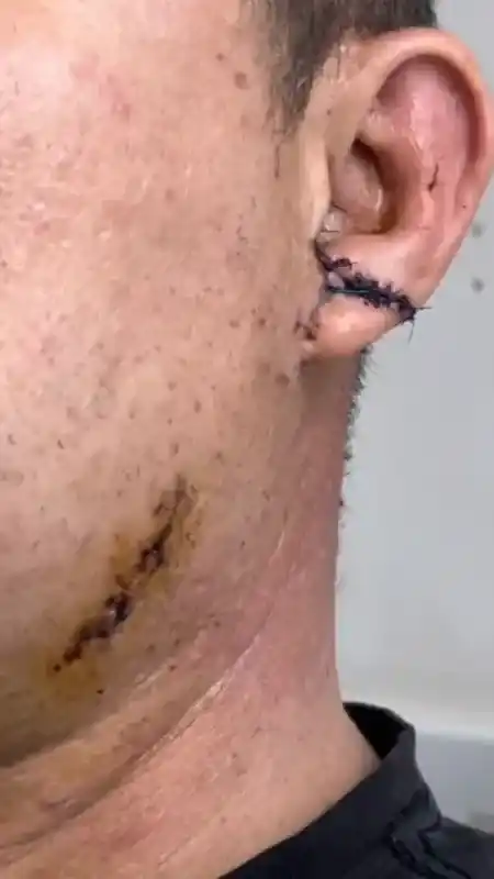  Bursa’da başıboş köpek dehşeti kamerada...Oğlu için kendini feda etti ölümden döndü