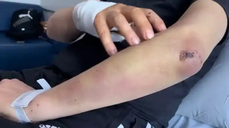  Bursa’da başıboş köpek dehşeti kamerada...Oğlu için kendini feda etti ölümden döndü