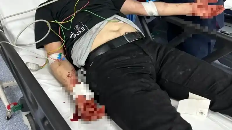  Bursa’da başıboş köpek dehşeti kamerada...Oğlu için kendini feda etti ölümden döndü