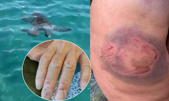 Antalya’da denizde caretta caretta kadına saldırdı