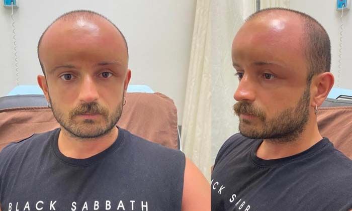 Serinlemek için denize gitti tıp tarihine geçti